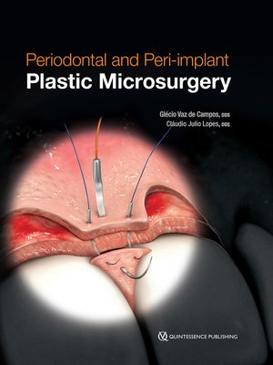 cover image of Periodontal and Peri-implant Plastic Microsurgery